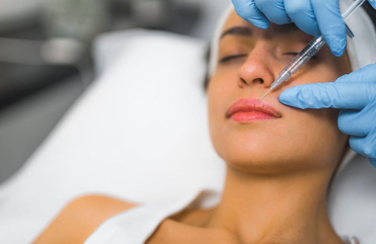 A woman receiving dermal fillers for smile lines at EstrogenicA clinic, a non-surgical treatment to smooth wrinkles and restore volume around the mouth.